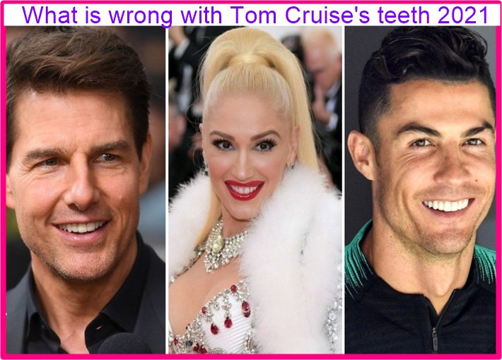 Tom Cruise's teeth